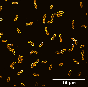 Averaged shifted histograms.tif_zoom_movie